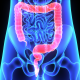 Colon cancer screening tests