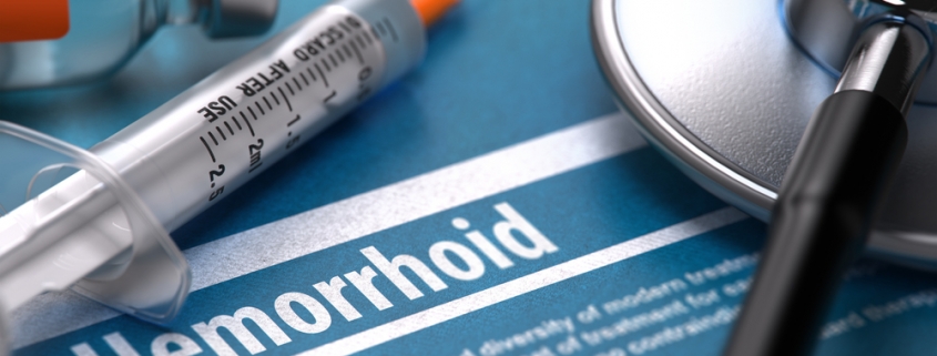 Learn about types of hemorrhoids here